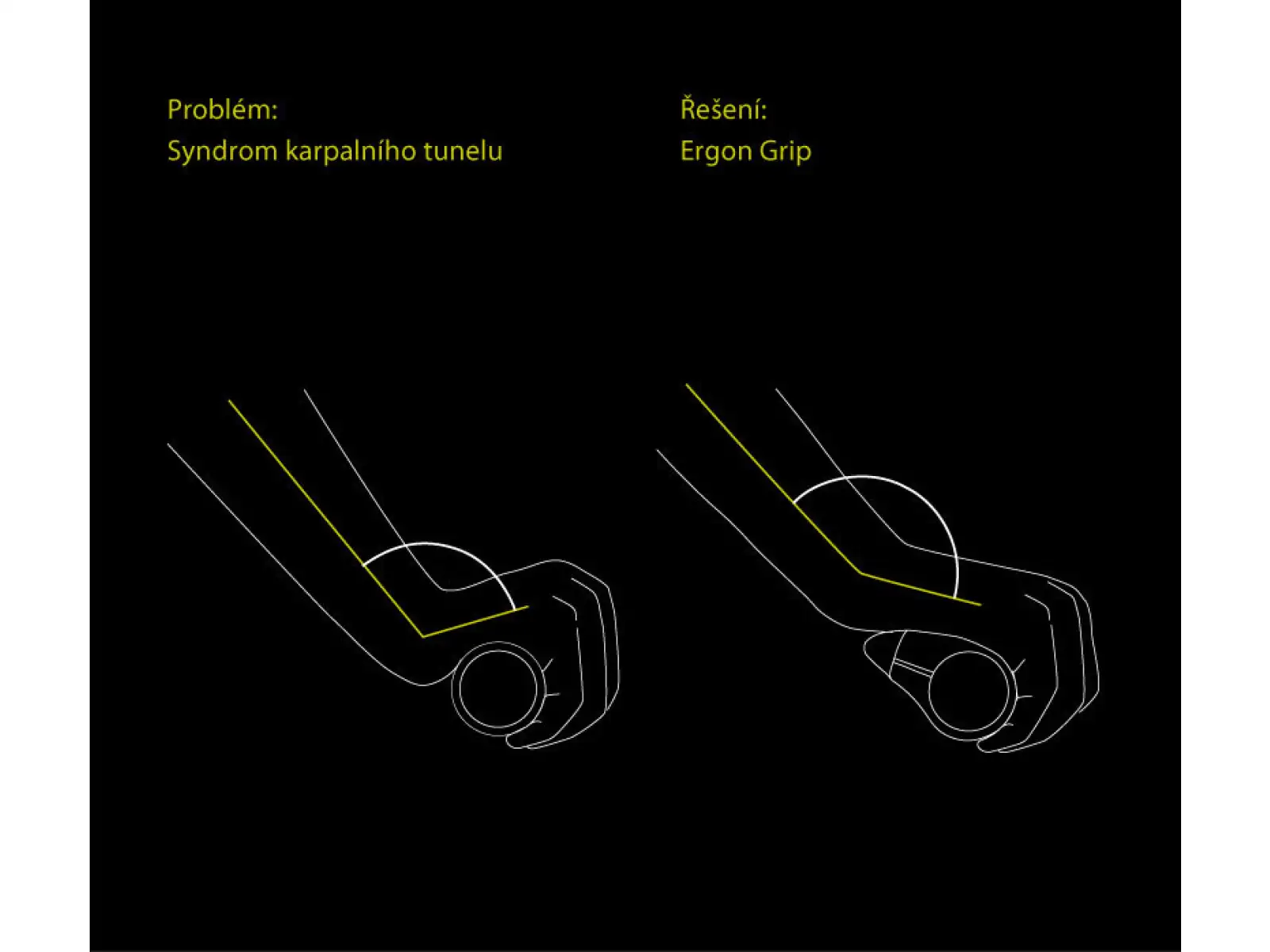 Ergon GP5 BioKork ergonomické gripy s rohy