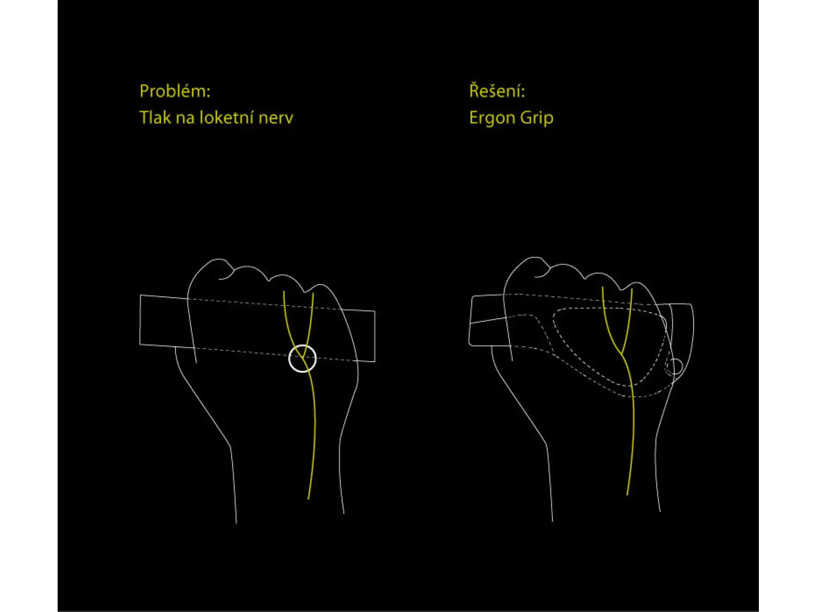 Ergon GP5 BioKork ergonomické gripy s rohy